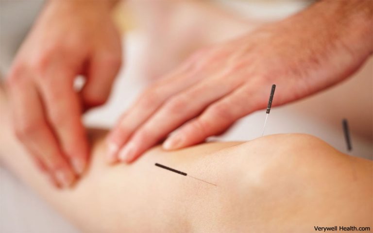 Uses of Acupuncture – The origin of acupuncture in China
